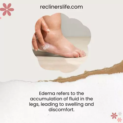 prolonged sitting in a recliner causes edema